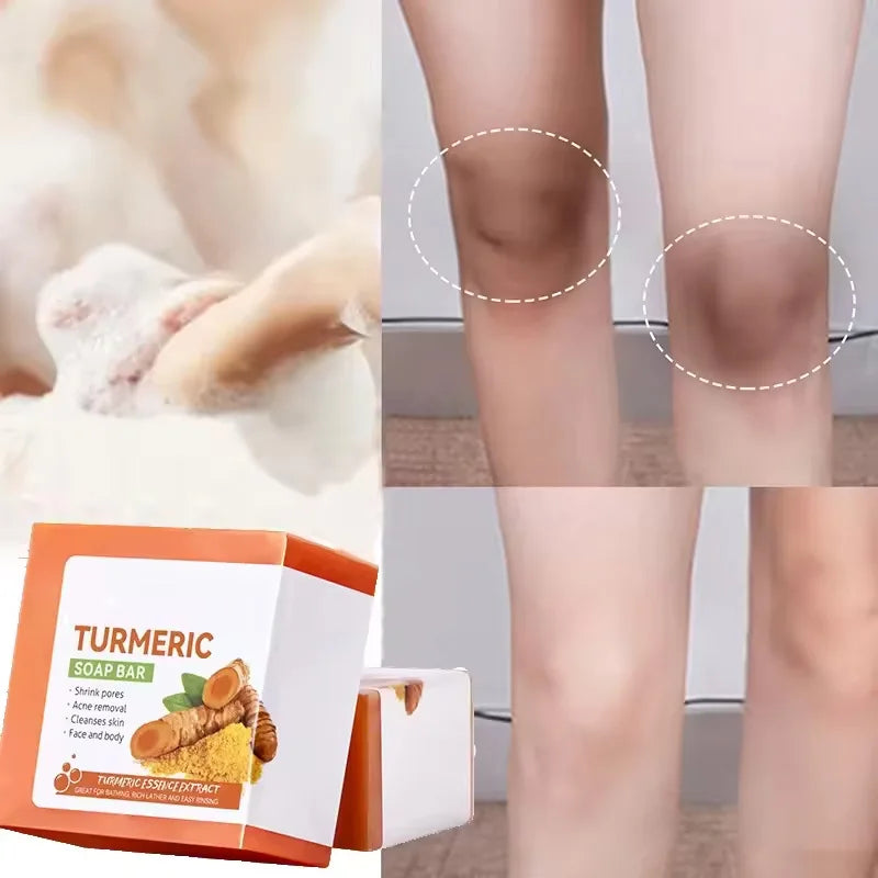 Natural Turmeric Soap Body Cleaning Lightening Dark Underarm Leg Bath Cleansers Brightening Face Soap Tender Skin Care Beauty