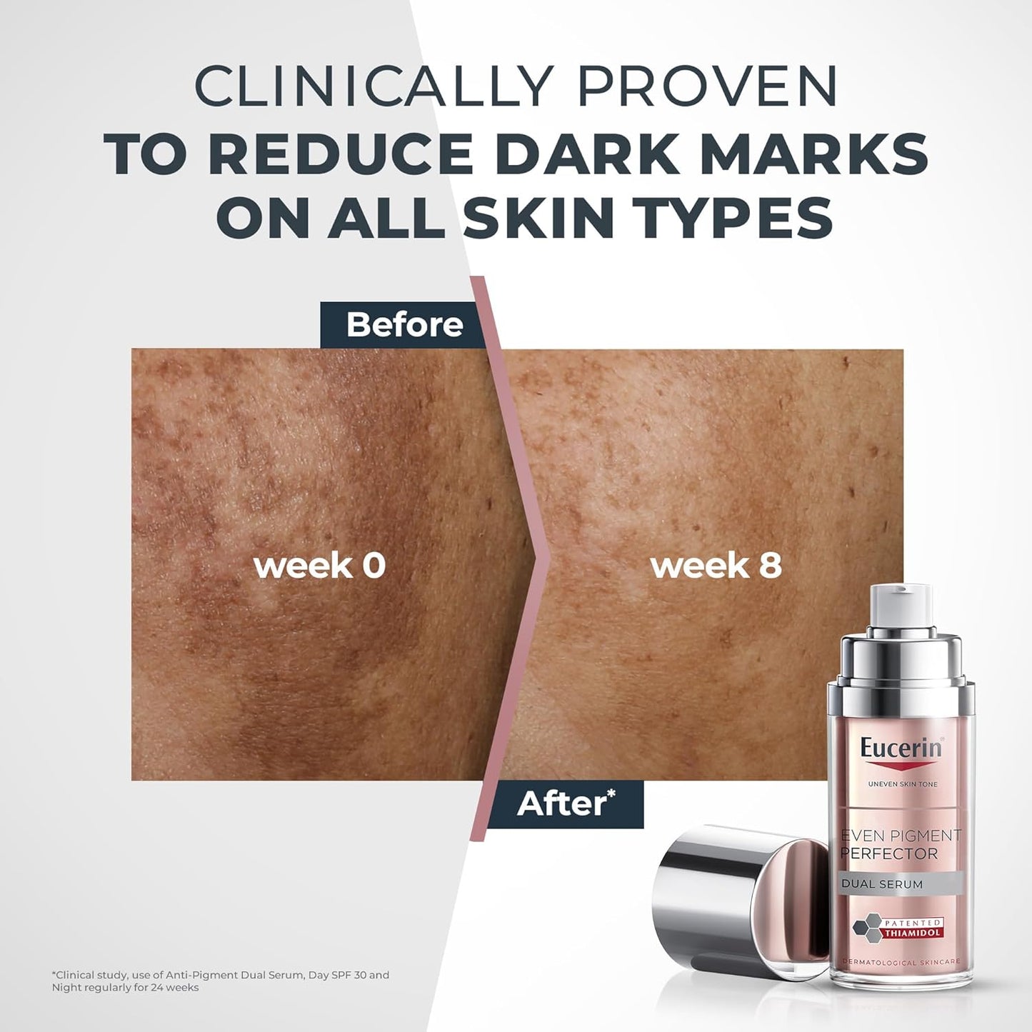 Eucerin Even Pigment Perfector Dual Serum, Moisturizes, Exfoliates and Refines Skin, Reduces Wrinkles and Dark Spots, Promotes Cell Renewal, 30ml