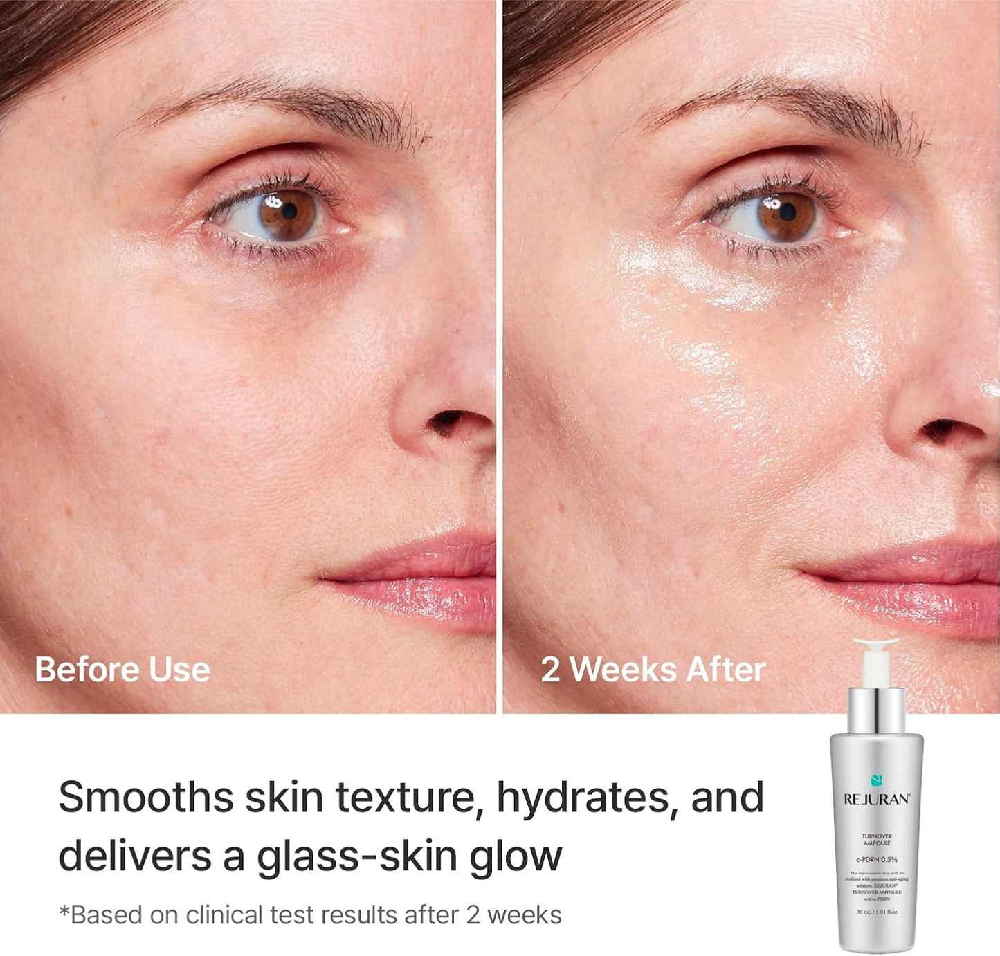 REJURAN® Turnover Ampoule, c-PDRN® – Original Salmon DNA PDRN Face Serum for Rejuvenation, Firming, Hydration & Youthful Glow, Refines Skin Texture. Korean Skincare (1.01 fl oz)