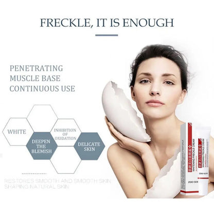 Whitening Cream Niacinamide Serum Moisturizing Facial Cream Brightening Anti-Freckle Lighten Reduce Dark Skin for Face Care